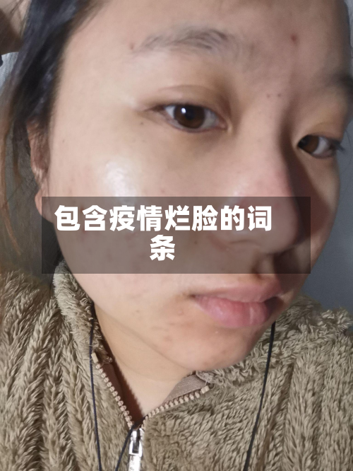 包含疫情烂脸的词条-第2张图片