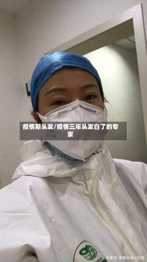 疫情期头发/疫情三年头发白了的专家-第2张图片