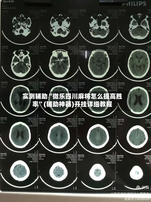 实测辅助“微乐四川麻将怎么提高胜率”(辅助神器)开挂详细教程-第1张图片